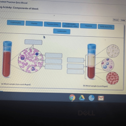 Art-labeling activity: components of blood.