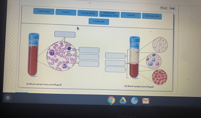 Art-labeling activity: components of blood.