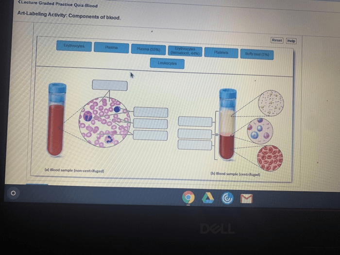 Art-labeling activity: components of blood.