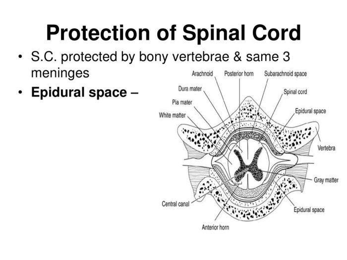 Labeling sectional spinal solved transcribed problem