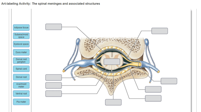 Art-labeling activity: protection of the spinal cord